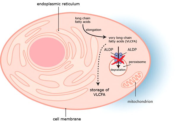 C311W411's tweet photo. peroxisomes? more like peroxiNOmes 🙅!! @PLysosomes causes ALD when unchecked! #MIO17 https://t.co/eqUGDfusjy