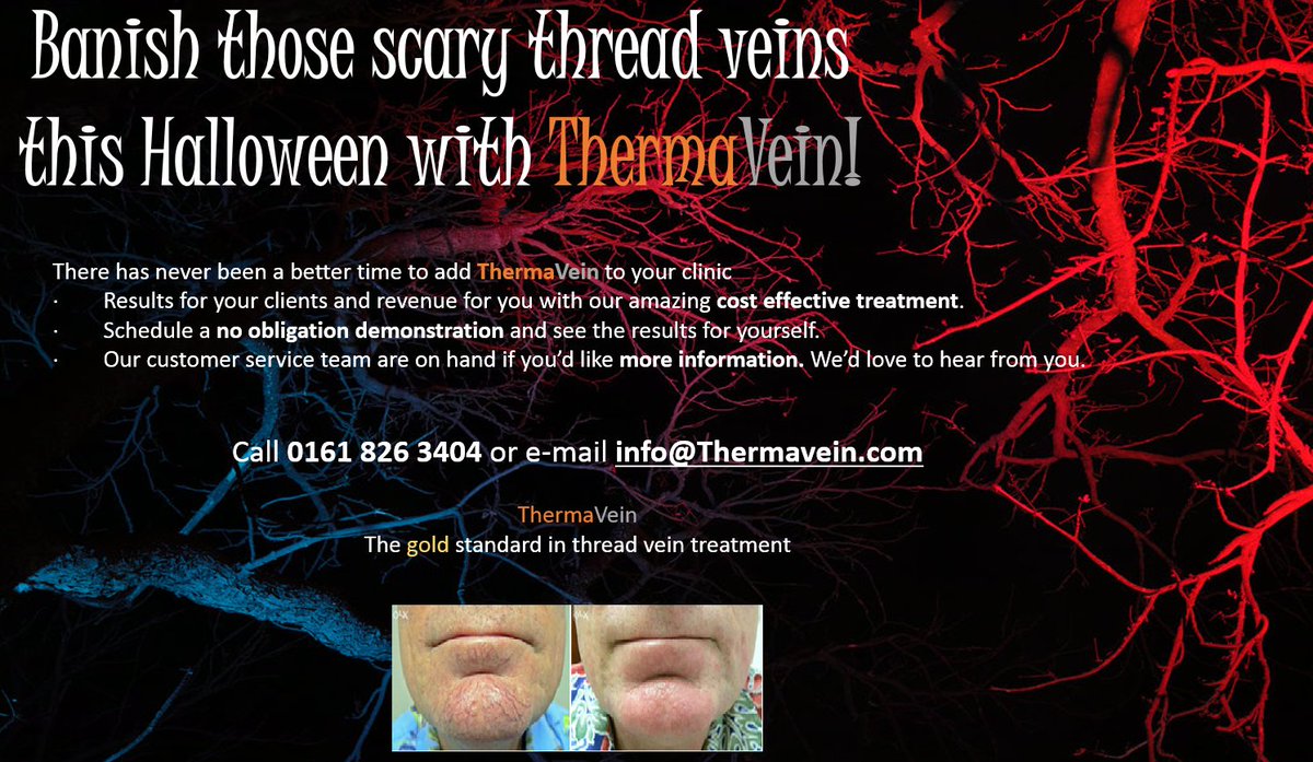 thermavein's tweet photo. #ThermaVein #threadveins #veins #aesthetics #Halloween #halloween2017 https://t.co/7bTACtBM1r