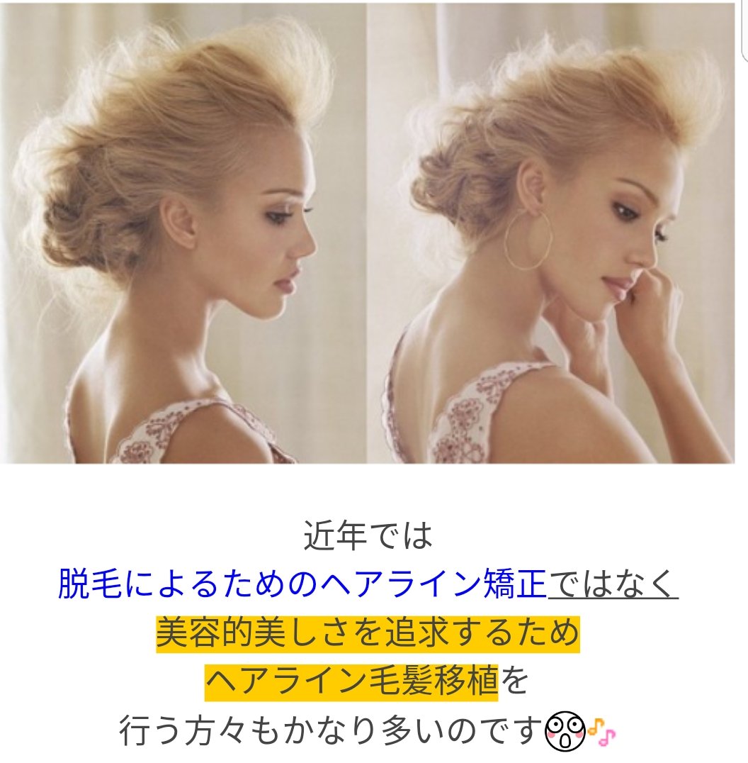 韓国美容整形 同行通訳 Vavico 韓国女優 アイドルたちが美しい理由 彼女たちの美の秘密に迫ってみました 詳しくはこちら Vavico バビコ 韓国女性 美の秘密 アップスタイル 顔が長い 面長 ヘアライン T Co Ndddmm58qn T Co 韓国美容整形 同行通訳 Vavico 韓国女優 アイドルたちが美しい理由 彼女たちの美の秘密に迫ってみました 詳しくはこちら Vavico バビコ 韓国女性 美の秘密 アップスタイル 顔が長い 面長 ヘアライン T Co Ndddmm58qn T Co