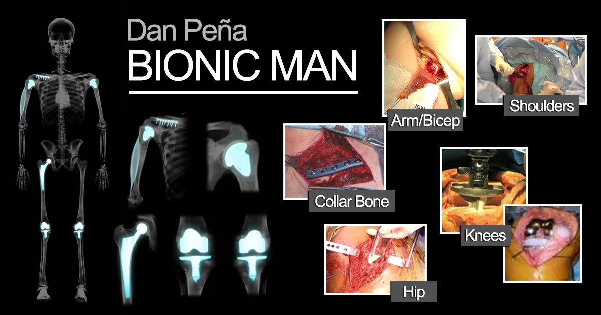 BEING “ALL U CAN B” CAN HAVE CONSEQUENCES,AS SHOWN ON MY OWN BODY-BUT I WUD NOT B THE QLA MAN I AM W/O PUSHING MYSELF MENTALLY &amp; PHYSICALLY!