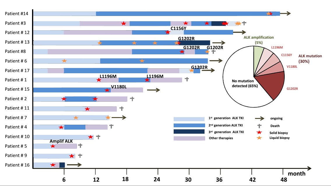 Cortot_Lille's tweet photo. 33% of ALK mutations by targeted NGS in routine practice, at progression on #ALK TKI. Jamme et al. Lille #WCLC2017 https://t.co/6o1l6hJC3O