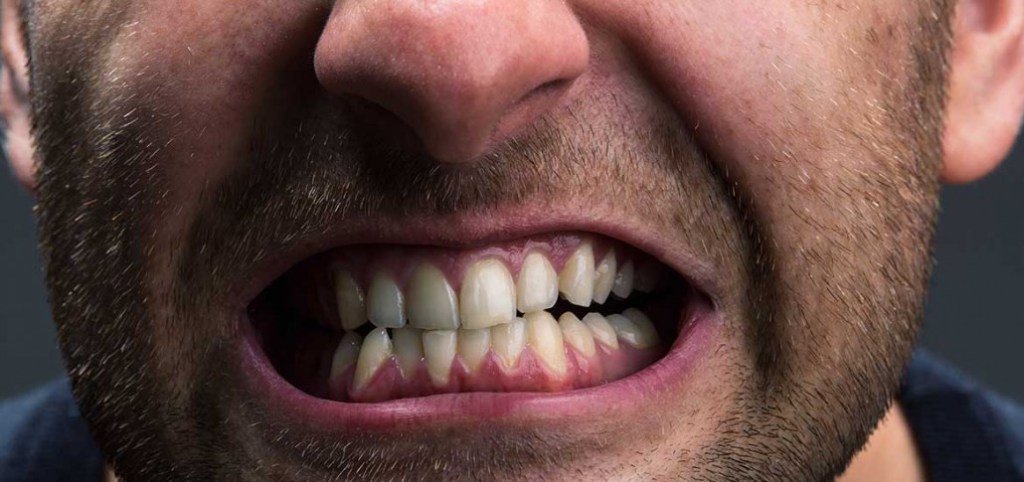 Teeth Grinding or Clenching: Things to know gdaonline.org/teeth-grinding…