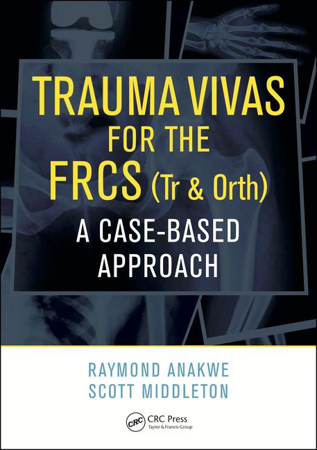CRCRevision's tweet photo. OUT NOW! Get your copy of 'Trauma Vivas for the FRCS: A Case-Based Approach' here: https://t.co/jdzahU54sW https://t.co/H4xMumCCPq