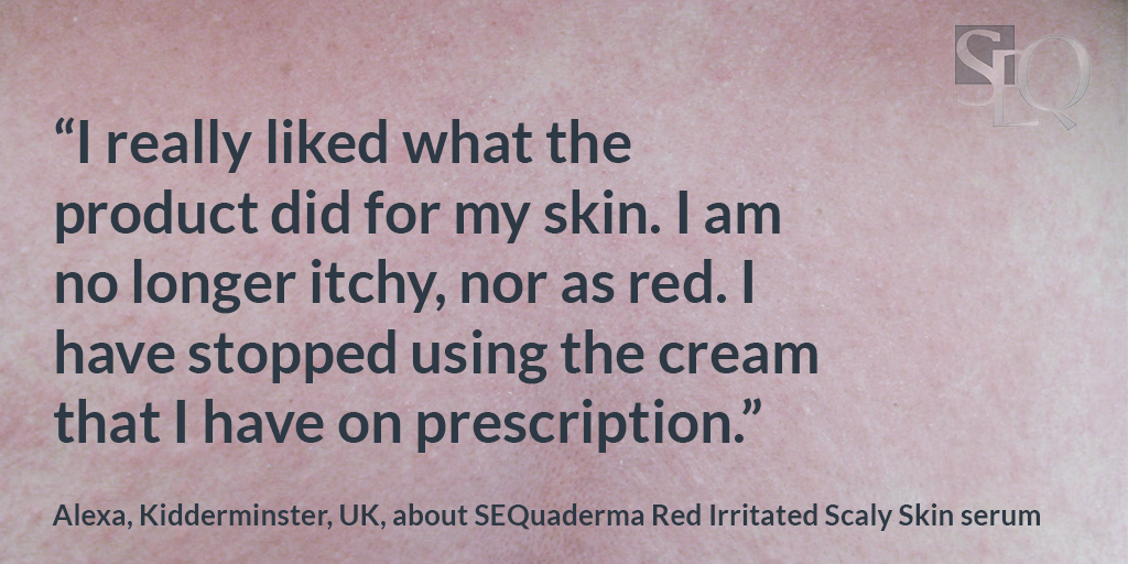 SEQuaderma's tweet photo. Suffer from #seborrhoeic #dermatitis? SEQuaderma #Red Irritated #Scaly #Skin serum is available @LloydsPharmacy @LloydsPharmIre  @superdrug @InishPharmacy @amazon @BourkesPharmacy #skincare #skincareroutine #hair https://t.co/b7zym8JGeu