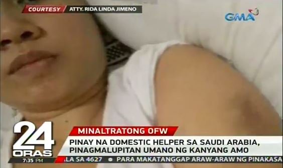 24OrasGMA's tweet photo. Sabunot, suntok at pananakal ang sinapit daw ng isa nating kababayan mula sa kanyang amo sa Saudi Arabia. Nakatutok si @bernadettereyes https://t.co/EvLvaMjzfB