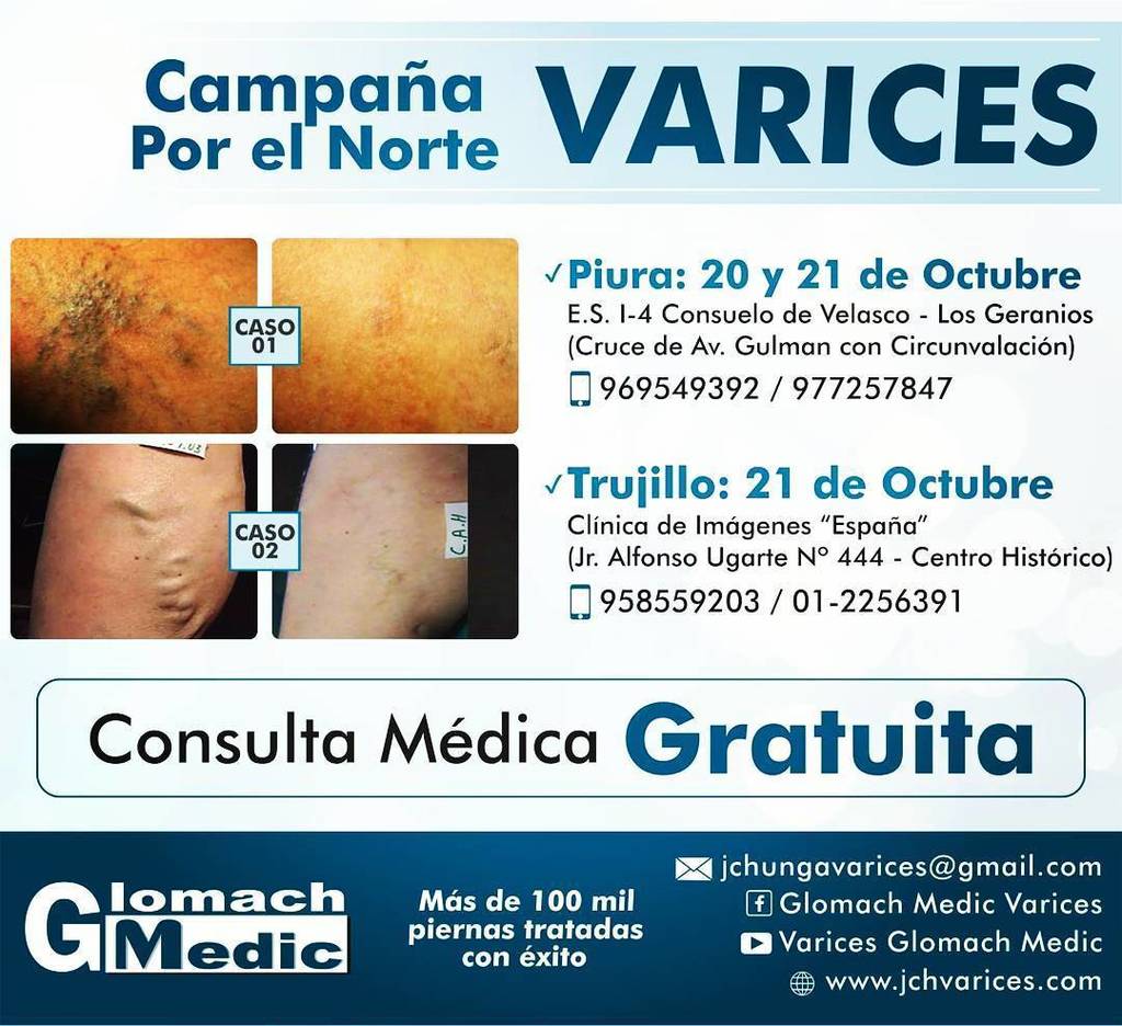 VaricesGlomach's tweet photo. #campañasdesalud #NoVarices #Flebologia #Norte #Piura #Trujillo#campañasdesalud #NoVarices #Flebologia #Norte #Piura #Trujillo https://t.co/oVOXBLgI3u