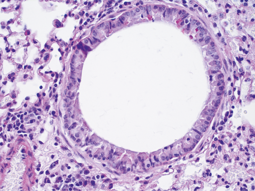 ULiegeRecherche's tweet photo. L’infection par un #gammaherpèsvirus peut protéger contre l’#asthme allergique. #ULiège #FARAH https://t.co/Y9D01YTkvw https://t.co/3a0nBStdXA
