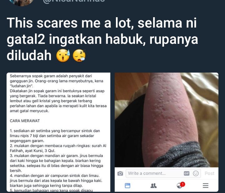 Punca Ludah Jin Sebab Gatal Merenyam Yang Perlu Kita Tahu Ini Ubat Dan Petua Boleh Dicuba Sinar Plus