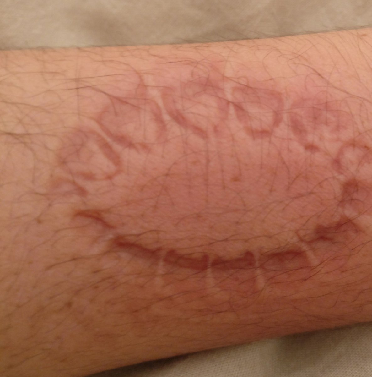 MatOrmenta's tweet image. Quand tu vient de faire une crise d'angoisse et qu'il a bien fallu te calmer