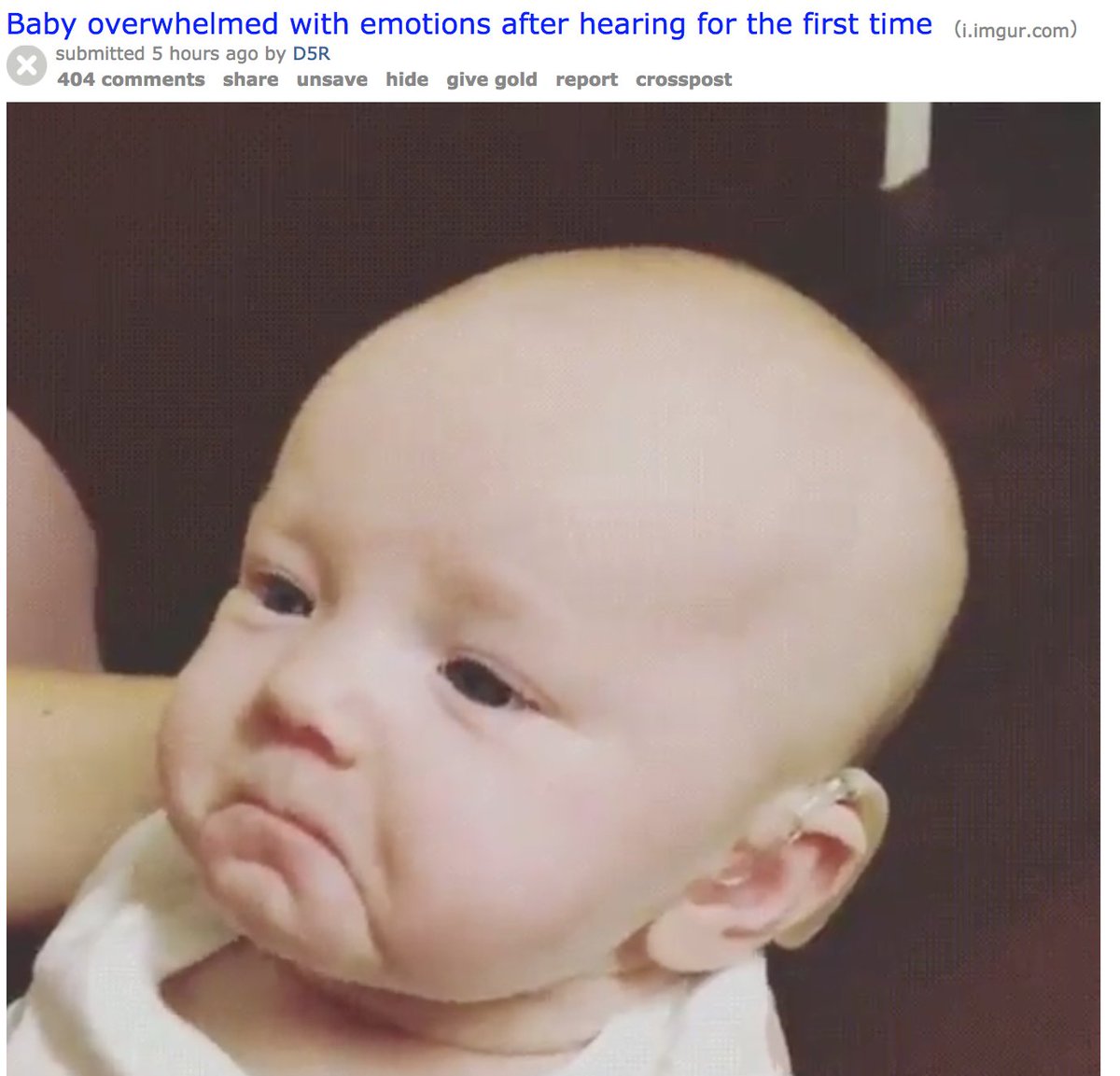 momoxmia's tweet photo. Reddit is doing that thing again. Just in time for Invisible Disabilities week too… #actuallydeaf https://t.co/WRtqLSz94F