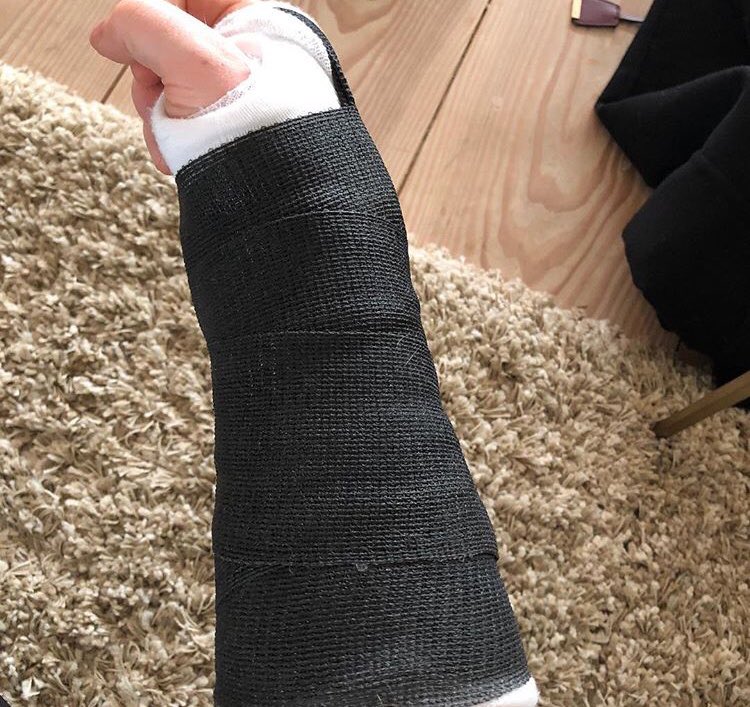 sheeranfacts's tweet photo. Como todos sabemos Ed tuvo un accidente y se ha fracturado su bella manito. Es por esta razón que ha suspendido su gira por Asia 😔 https://t.co/mwg2OfQuK9