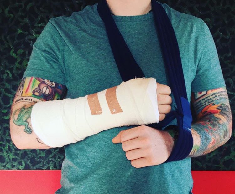 sheeranfacts's tweet photo. Como todos sabemos Ed tuvo un accidente y se ha fracturado su bella manito. Es por esta razón que ha suspendido su gira por Asia 😔 https://t.co/mwg2OfQuK9