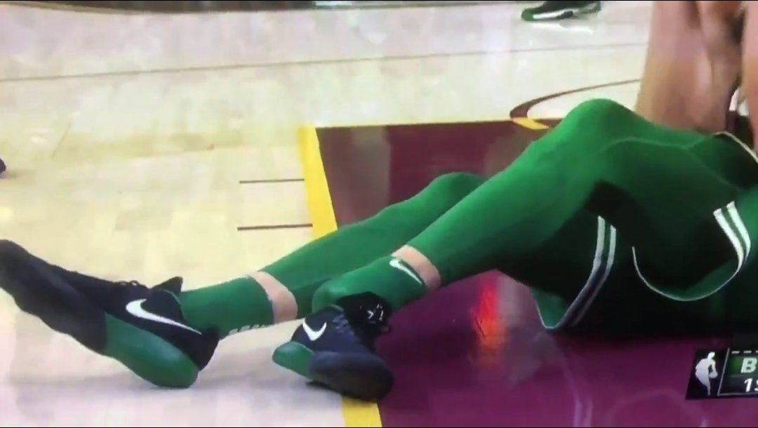 RCLayese's tweet photo. Shit! 😫 #PrayForGordonHayward https://t.co/1Tl34tHGs5