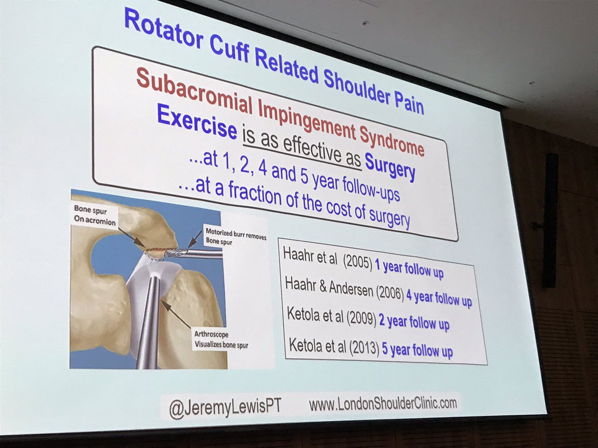 peralta_pj's tweet photo. Exercise is as effective as surgery @JeremyLewisPT found by every study!! #APAmomentum https://t.co/sRGkDsCaMg