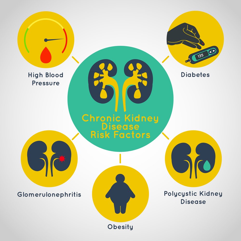 There are numerous steps  #physician will take before #diagnosing someone with #chronic #kidney #disease. goo.gl/eWxXd5