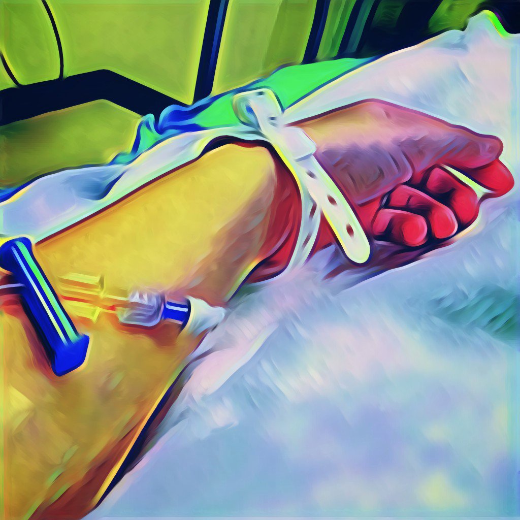 KateDalleva's tweet photo. Hubby wants me to relax and recover in bed... but these meds make me want karate kicks and #artprojects. #postop https://t.co/PYjMQkgn53