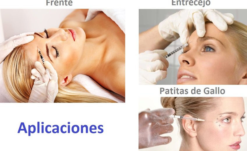 dermacarespa's tweet photo. #toxinabotulínica, aprovecha nuestra promoción de fin de año con evaluación médica gratuita, no esperes a última hora para rejuvenecerte. https://t.co/XXaM1eWeAa