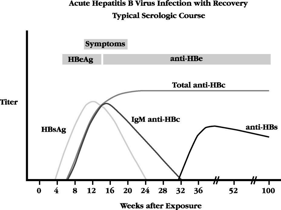 BHD_GI_LIVER's tweet photo. HBV serology profile! Geek out with the Hepatologists and play our favorite game! #guesstheserologies #smallgroup1 https://t.co/H9GsnJHQFx