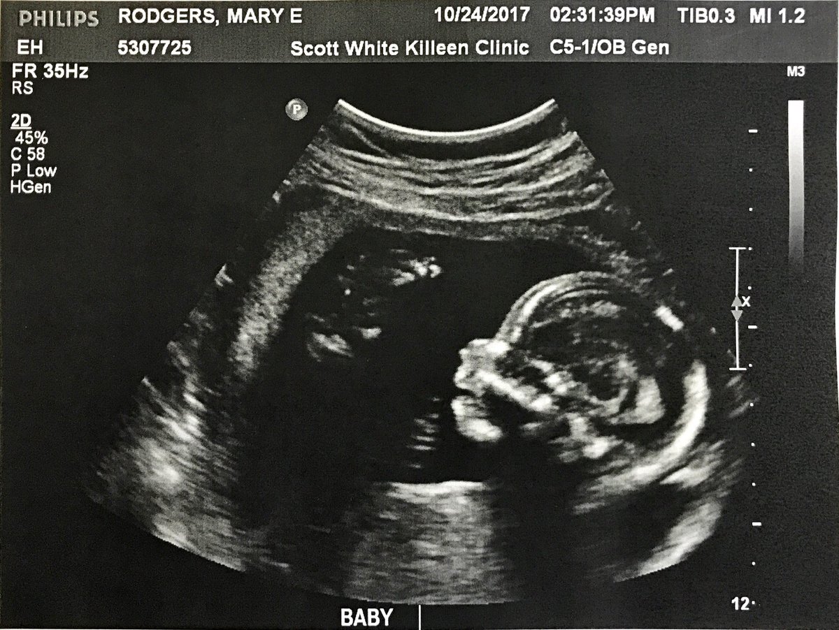 Coach_Rodgers_'s tweet photo. Baby girl Rodgers coming this March! https://t.co/ugObkofhgv