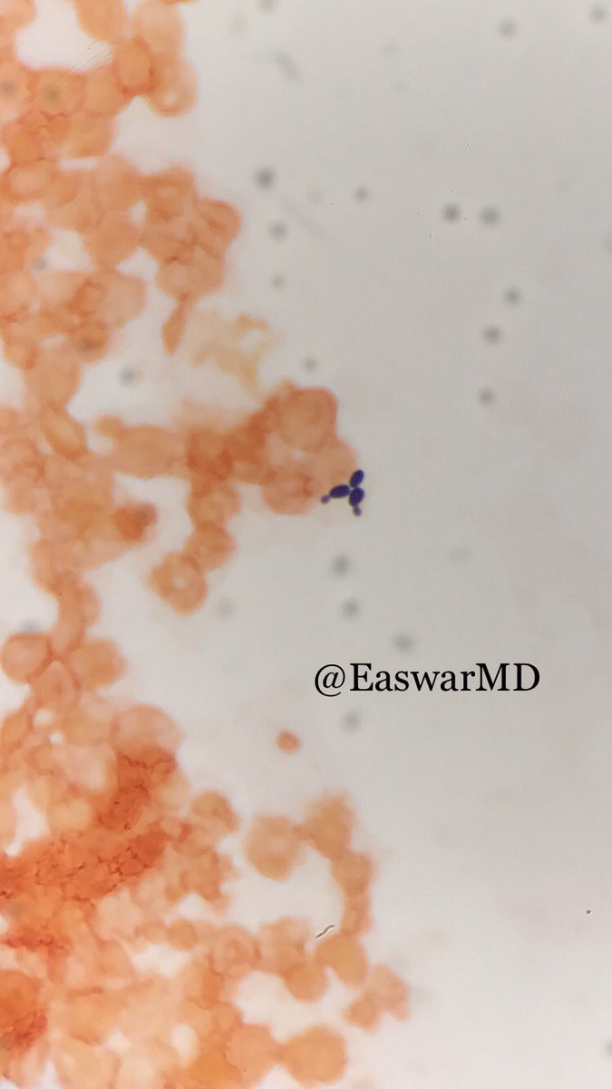 EaswarMd's tweet photo. Budding yeasts on a gram stain from a blood culture. #gramstain #micro #hhpath #pathologyart https://t.co/zjr6rkKGNZ