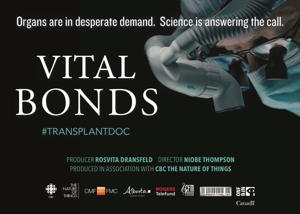CanadaHungary's tweet photo. Canadian-produced #TransplantDoc 🎞️ #VitalBonds won 🏆 1st prize at #Szolnok 🇭🇺 Int'l Scientific Film Festival. Congrats to the 🇨🇦 team! https://t.co/4TKQTfgNEK