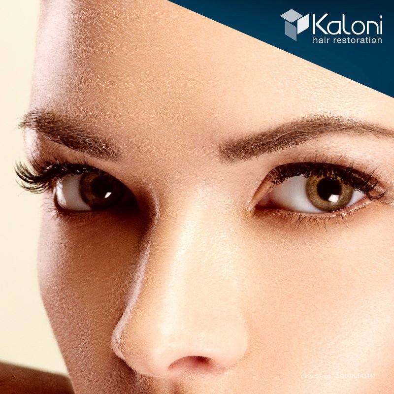 KaloniHairUsa's tweet photo. With the #EyebrowGraft we take care of giving prominence and expression to the eyes and the face itself. #KaloniEyebrows https://t.co/IfvvR5Yjcs