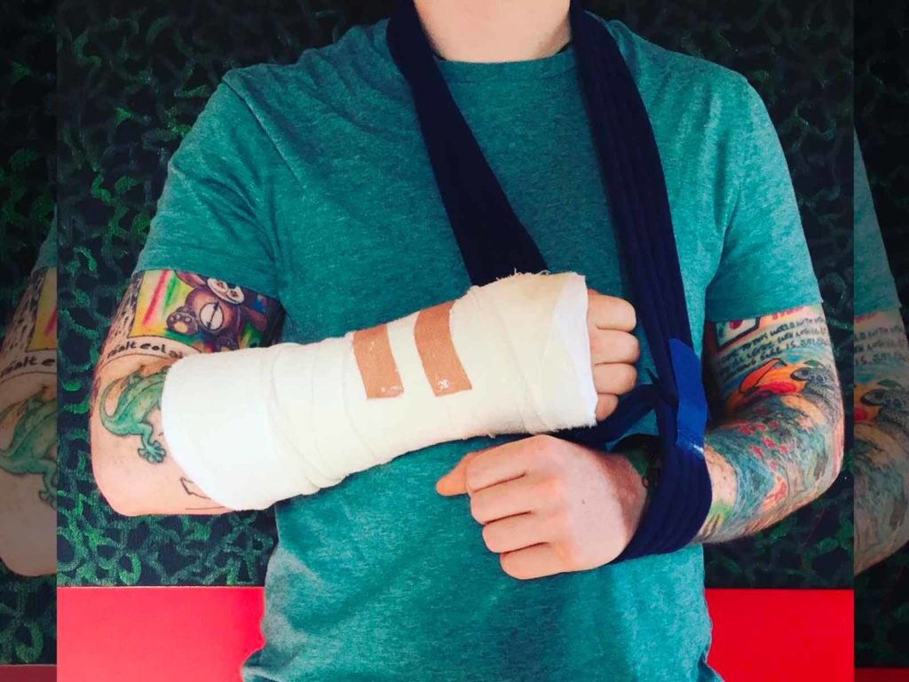 When his arms don't work like they used to before and he can't play the strings the same way... 🙈🙊🙉 Get well soon <a href="/edsheeran/">Ed Sheeran HQ</a> 🤕❤️