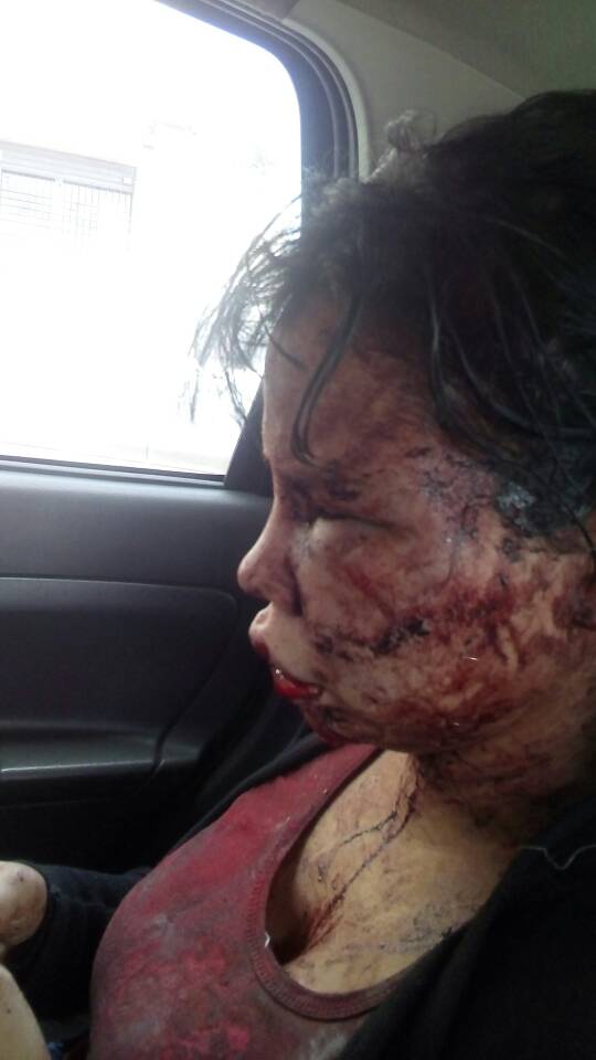 Danielap07's tweet photo. Hasta cuando lo mismo? Esta vez le tocó a una conocida y no saben la rabia y la impotencia que me da... Ojala se MUERA este maldito. https://t.co/LJGZwJpMMF