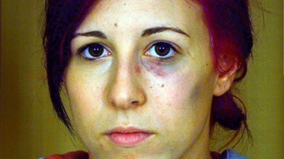 _dinasalah's tweet photo. shorty after demi beat her ass. her face looks like she took more than one hit. demi hit her with the ole 1 2..maybe even a 3 https://t.co/Ie804Xex5l