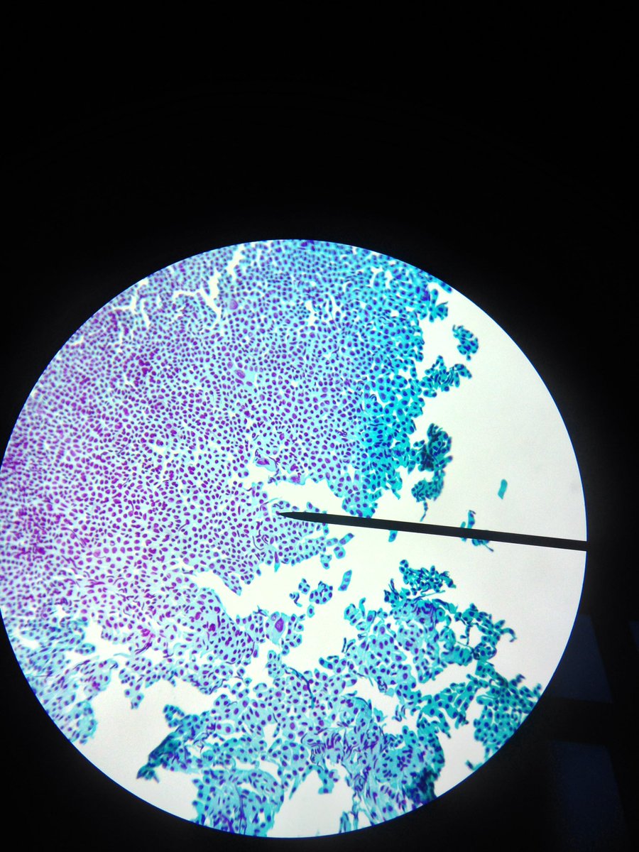 j11p43f's tweet photo. The squashed root tip of Allium, onion, at x10, x40 and x100 magnification
#MicroscopeScience #BiologyIsAwesome #PlantsAreCool https://t.co/2RNlG6rC1y