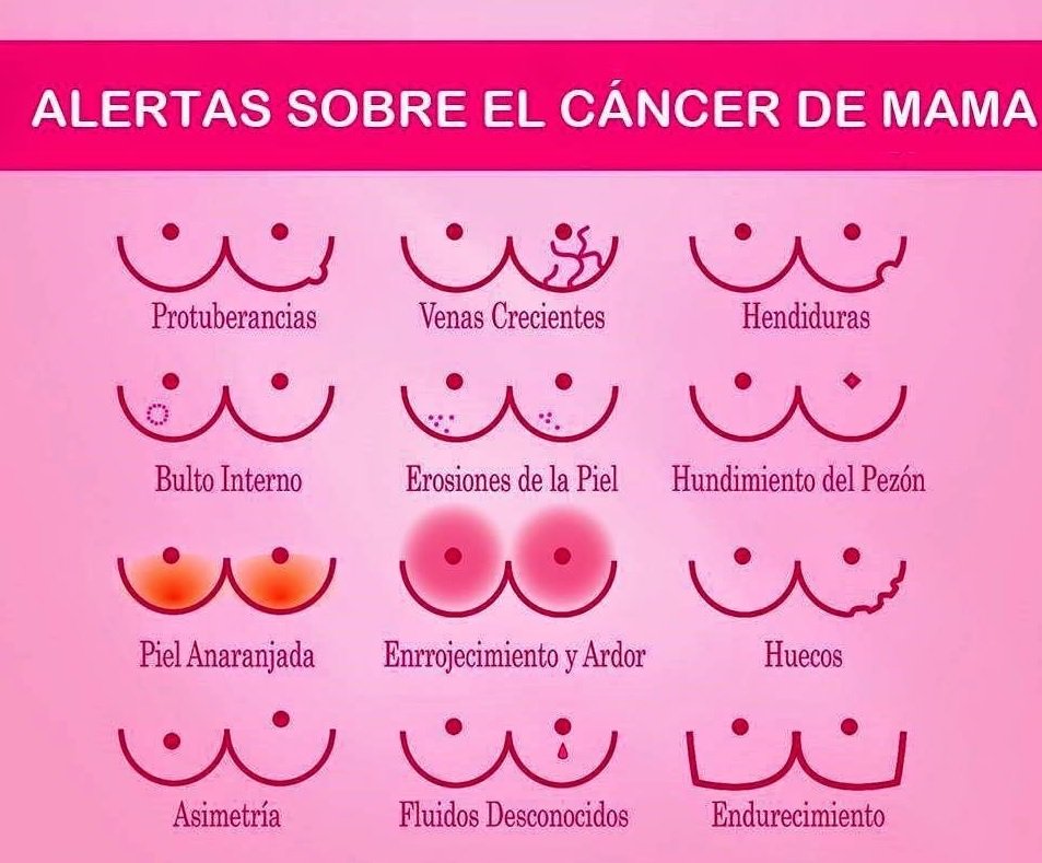 1 de cada 8 dones tindrà càncer de mama. Si es detecta a temps, gairebé el 100% es cura 💗💪🏼💗 #diamundialdelcancerdemama #SúmateAlRosa