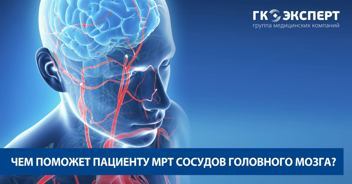 Мрт сосудов головного мозга в туле. Мрт головного мозга и сосудов. эксперт тверь мрт головы. головная боль мрт. мрт головного мозга и сосудов в туле отзывы.