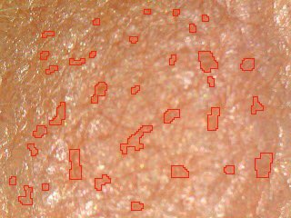 sonettedonker's tweet photo. With my new skin analysis device I can measure your pore size and compare it to others your age. #skinid #skinstudio https://t.co/HWNc9Y8WDE
