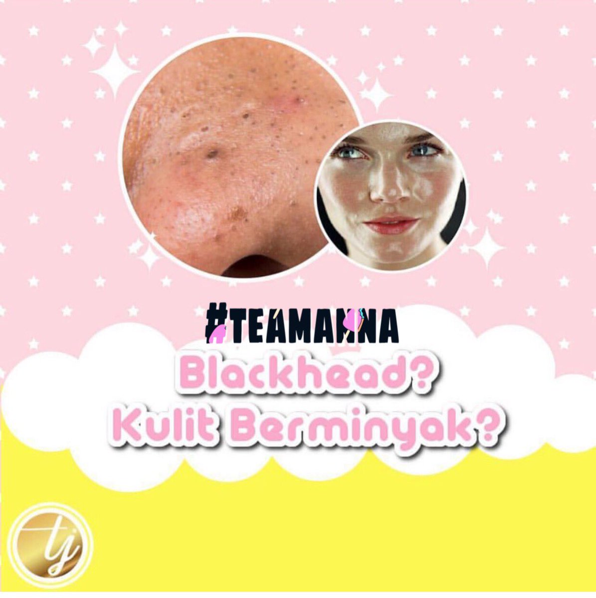 agentthejunnijb's tweet photo. Hapuskan blackhead dgn #thejunni 💁🏼 https://t.co/jQBnm8Pqm9