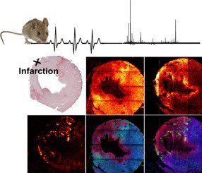 Drjsf's tweet photo. Not formatted yet but Sannas new paper "Localised Lipid Accumulation  in Infarcted Mouse Heart Tissue" is online: https://t.co/rHB6LTRzoL https://t.co/pp6yXeVqKd