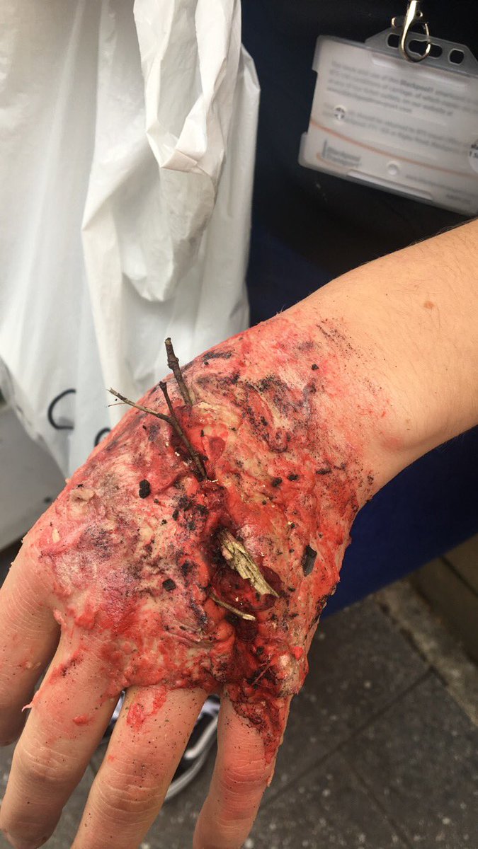 chlotipping's tweet photo. @B6FC_UPS such a good lesson with the army medical team https://t.co/0E6WmXHYMD