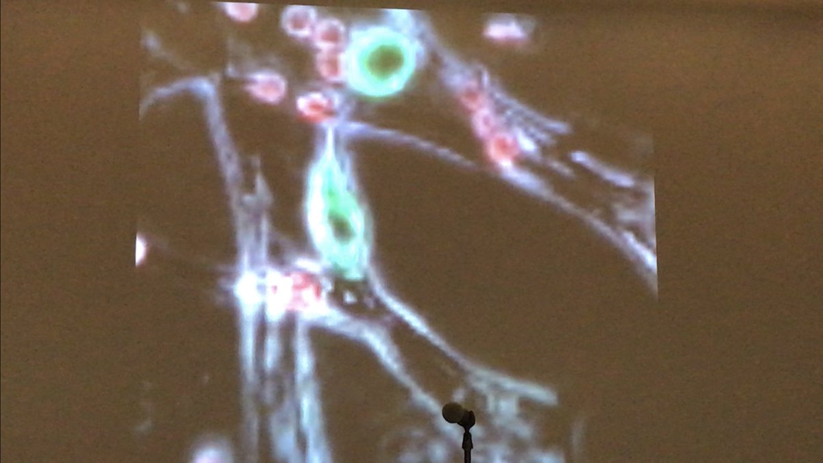 ara_anderson's tweet photo. Kamm has some incredible movies! He is showing neutrophils interacting with tumor cells & vasculature - unpublished though sorry! #2017PSON https://t.co/YI8ekFl5to