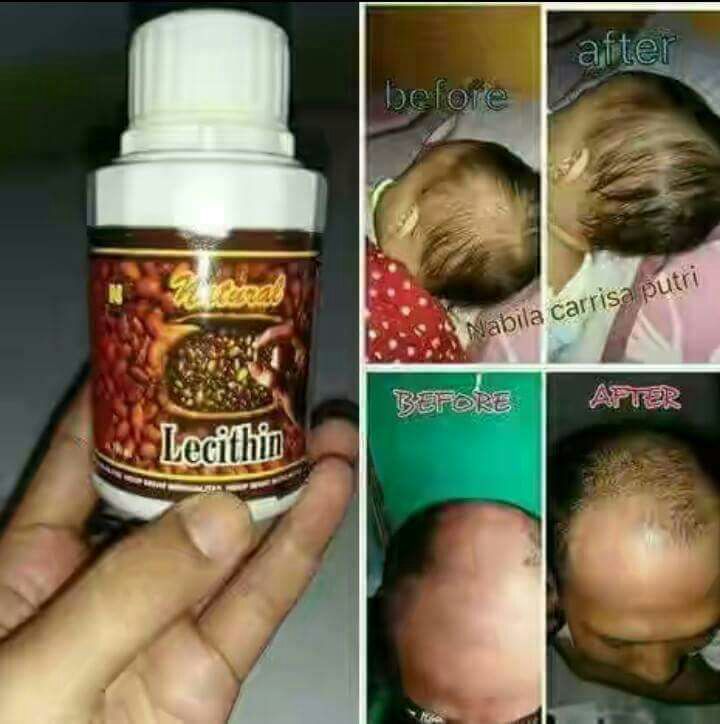 Dick  Nieng (@cintaduomus) on Twitter photo 