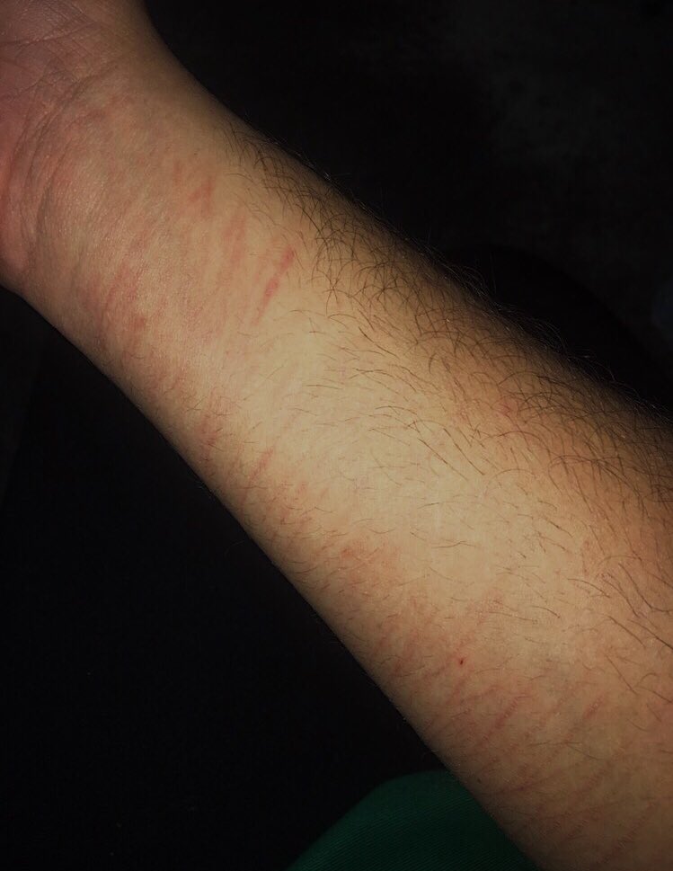 cayaliesemusic's tweet photo. no more blood. my heart is healed. there are scars, but I have come so far. #SuicideAwareness #SelfHarmAwareness #Recovery #HealedHearts https://t.co/QOmXoAtDmc