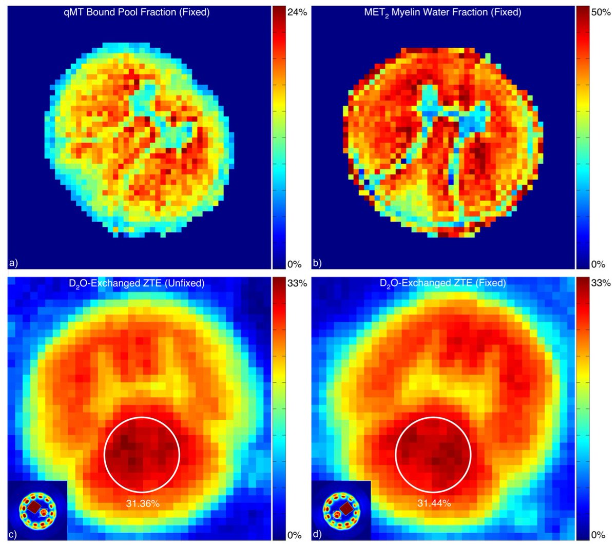 JunqianXuLab's tweet photo. Dr @alancseifert @MtSinaiPostdocs presented poster "Impact of Formalin Fixation on Myelin-Sensitive MRI Methods" in the @bic_ismms symposium https://t.co/AZpJ8ir149