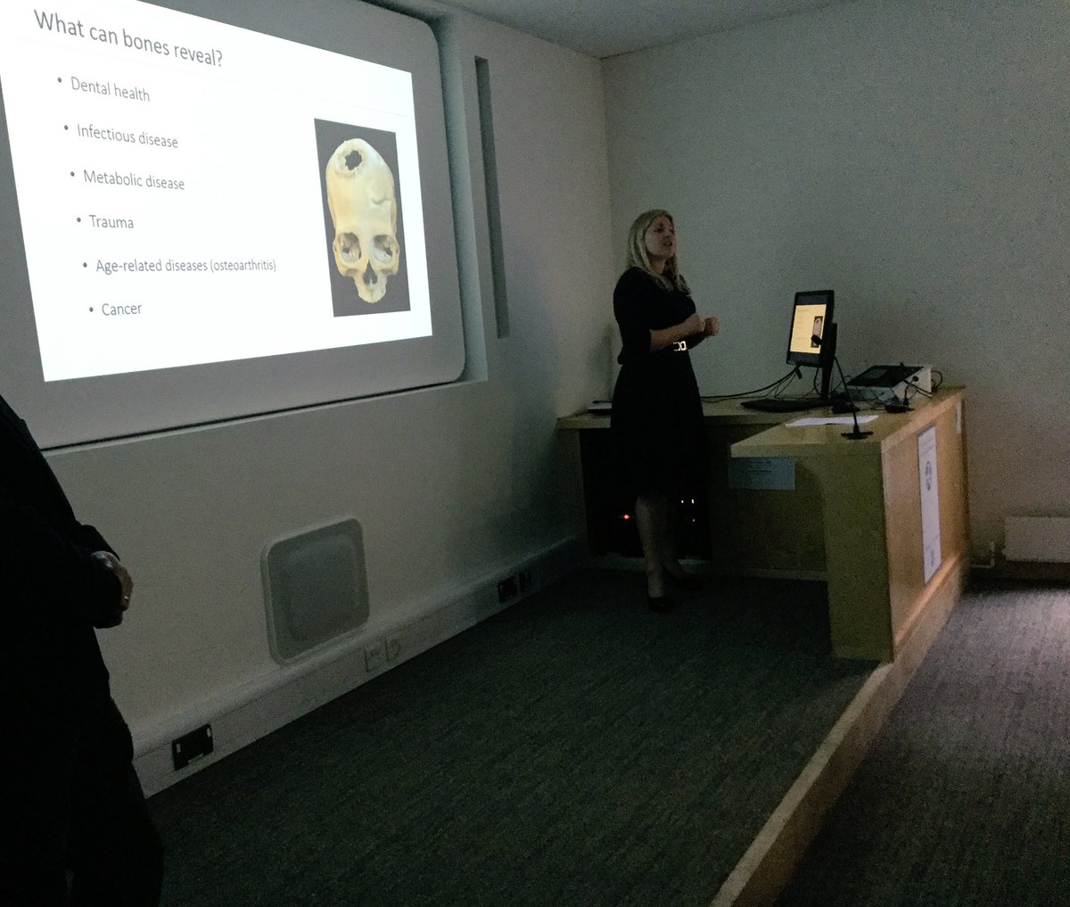 What can bones reveal about disease in the past? Palaeopathologist Jenna Dittmar discusses at <a href="/camideasfest/">Cambridge Festival of Ideas</a> public talk. #CFI2017