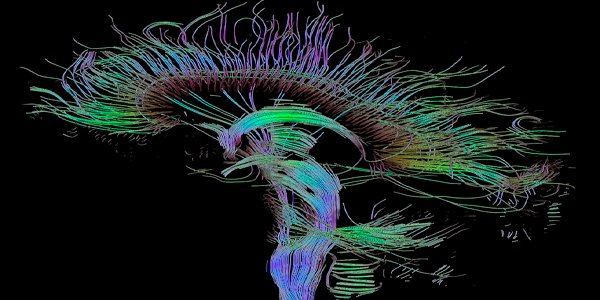 Wits_News's tweet photo. Wits biomedical engineer @apophenist &amp; postgrads connect human brain to internet in possibly world 1st research. https://t.co/CoLSybtGbg https://t.co/jX0vKZ8dAb