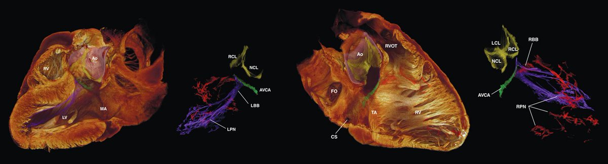 AmSciMag's tweet photo. High-resolution #3D imaging of a human #heart? 7 years of #SciencePatience https://t.co/nHBRZ7TJLD #video #podcast https://t.co/YEUwAXoEke