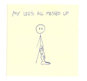jpnsntbk's tweet photo. My leg's all messed up https://t.co/znZJC2qMRt