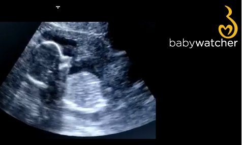 MyBabywatcher's tweet photo. This is how it looks like by making your own Babywatcher-echo. 
Start now at https://t.co/oJLXCmLTxp https://t.co/DA59i9e03a