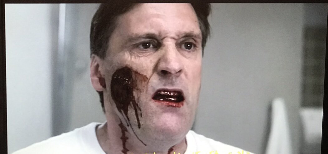 MhSa_13's tweet photo. پوستش كنده شد به روايته تصوير😂🔪
#Supernatural #Gorgeous 
#skin https://t.co/FIKsHE1UwJ