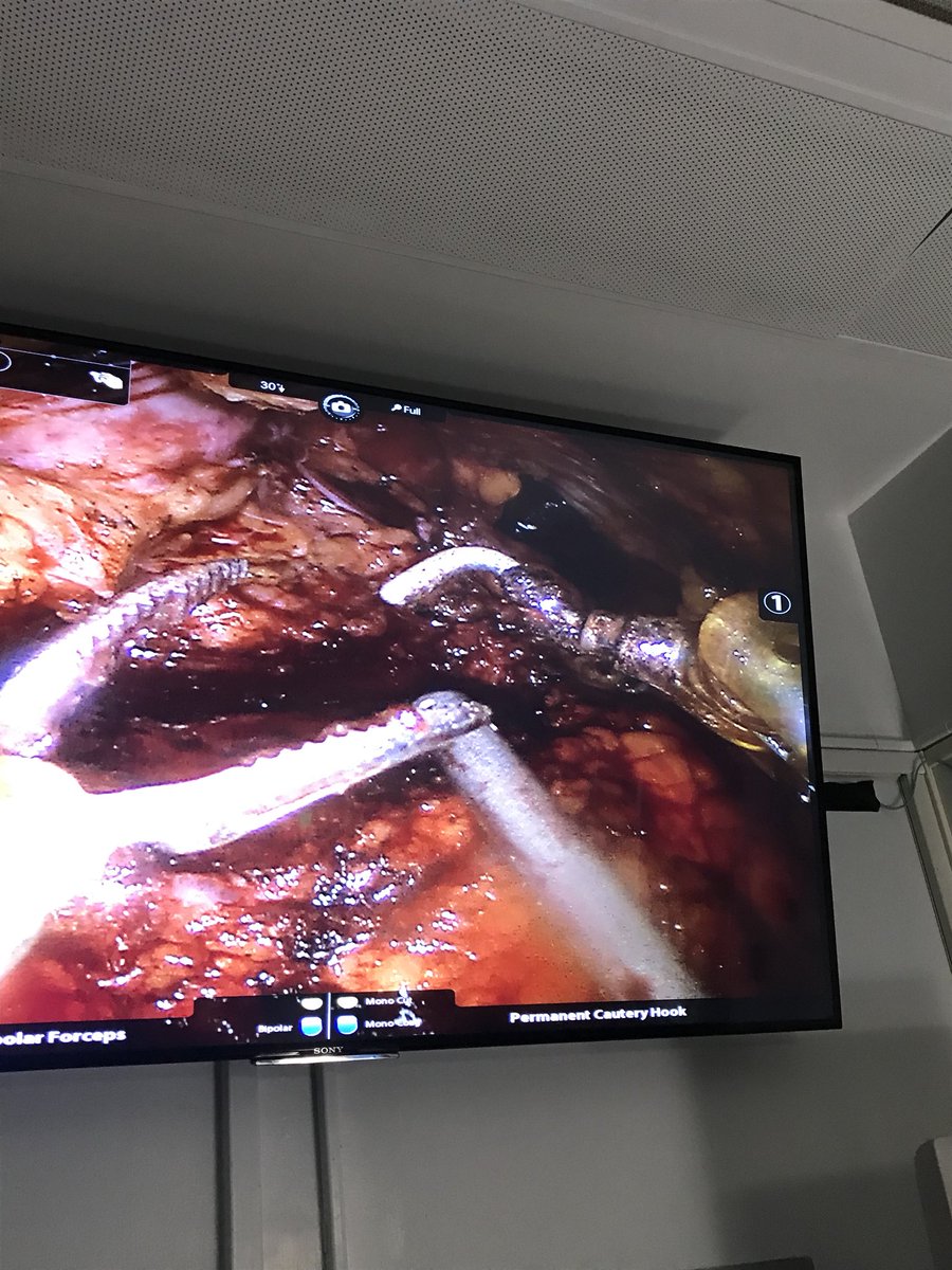 Temple Urology on Twitter "Every case. to the revolution.…