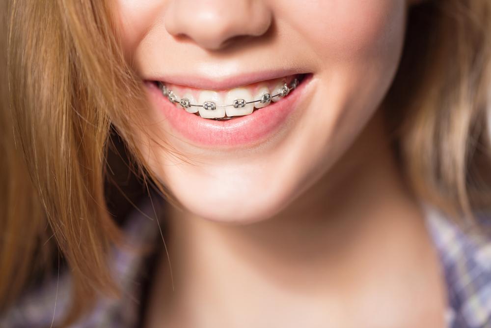 ForestOrthopedo's tweet photo. October is National Orthodontic Health Month! Learn how orthodontic treatment can help you improve your smile. 😁 Contact us today! https://t.co/6TFcviRmDW