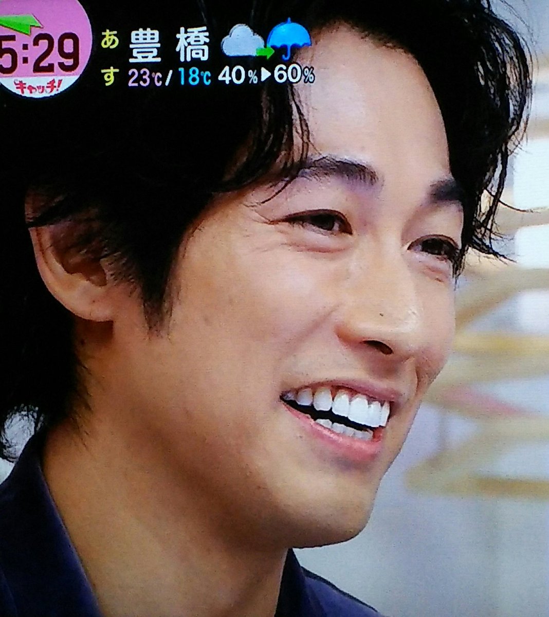 みーコ おでぃんさんの鼻の上のほくろ いつから濃くなったんだろう 最近気になる ちょっと前まであまり目立たなかったような みーコ おでぃんさんの鼻の上のほくろ いつから濃くなったんだろう 最近気になる ちょっと前まであまり目立たなかったような