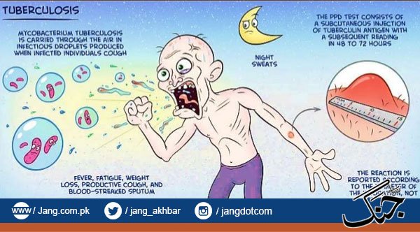 jang_akhbar's tweet photo. بلوچستان و کے پی میں ٹی بی کنٹرول پروگرام کا موبائل سینٹر قائم نہ ہونے کا انکشاف
https://t.co/8FyXJtAOSx
#Balochistan #KPK #TBControlProgram https://t.co/Ov9JvNy0P0